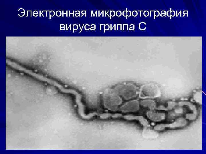 Электронная микрофотография вируса гриппа С 