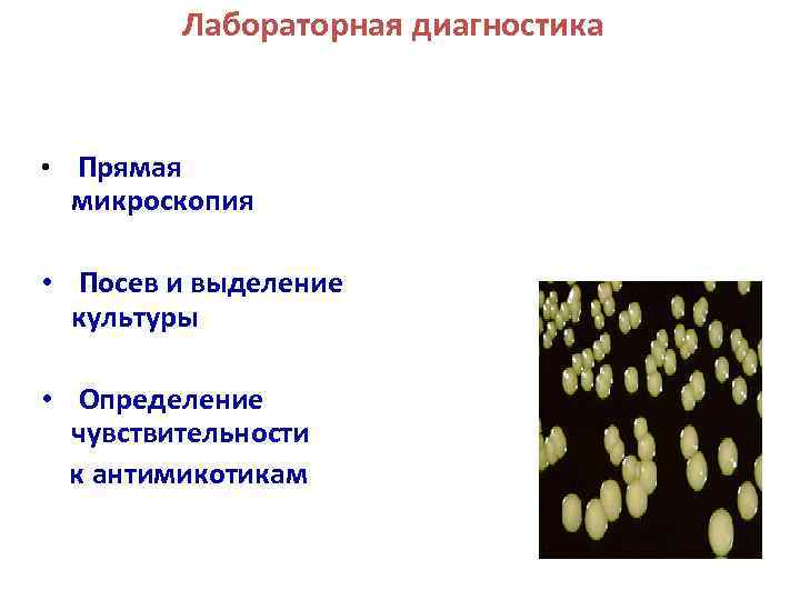 Лабораторная диагностика • Прямая микроскопия • Посев и выделение культуры • Определение чувствительности к