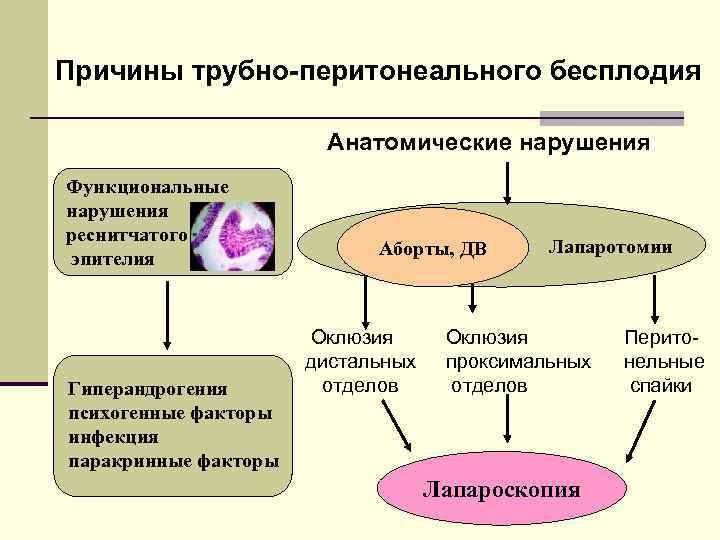 Причины трубно-перитонеального бесплодия Анатомические нарушения Функциональные нарушения реснитчатого эпителия Гиперандрогения психогенные факторы инфекция паракринные