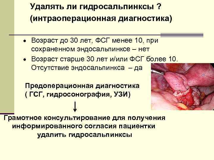 Удалять ли гидросальпинксы ? (интраоперационная диагностика) · Возраст до 30 лет, ФСГ менее 10,