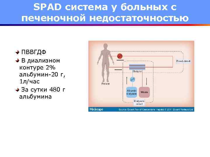 SPAD система у больных с печеночной недостаточностью ПВВГДФ В диализном контуре 2% альбумин-20 г,