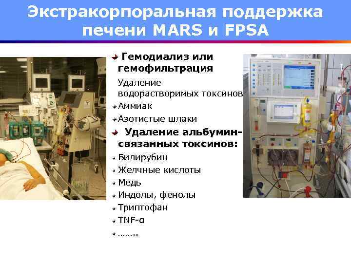 Экстракорпоральная поддержка печени MARS и FPSA Гемодиализ или гемофильтрация Удаление водорастворимых токсинов Аммиак Азотистые