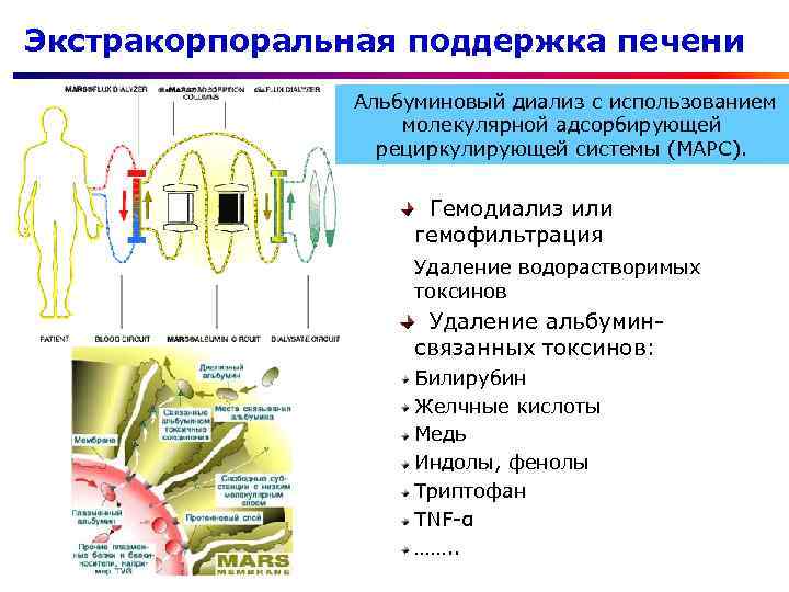 Экстракорпоральная поддержка печени Альбуминовый диализ с использованием молекулярной адсорбирующей рециркулирующей системы (МАРС). Гемодиализ или