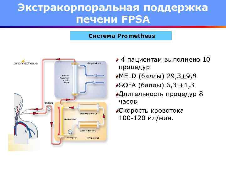 Экстракорпоральная поддержка печени FPSA Система Prometheus 4 пациентам выполнено 10 процедур MELD (баллы) 29,