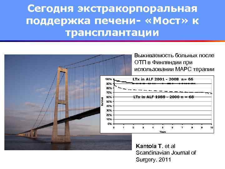 Сегодня экстракорпоральная поддержка печени- «Мост» к трансплантации Выживаемость больных после ОТП в Финляндии при