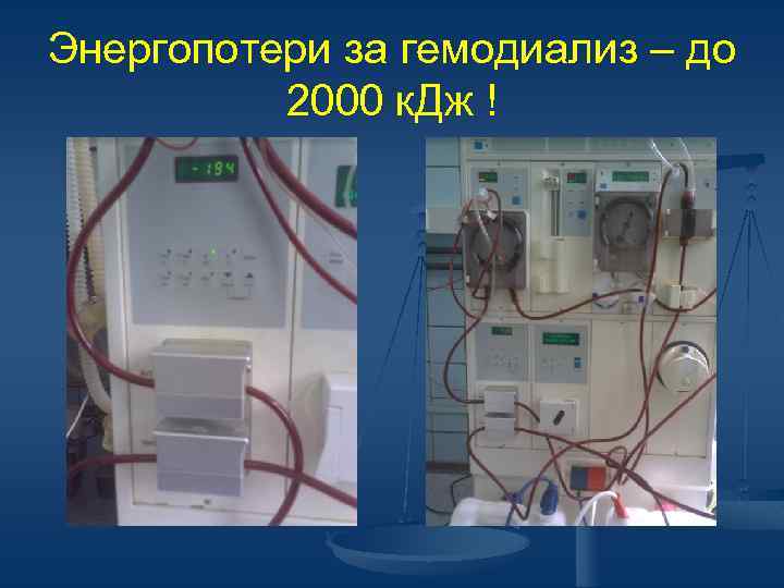 Энергопотери за гемодиализ – до 2000 к. Дж ! 