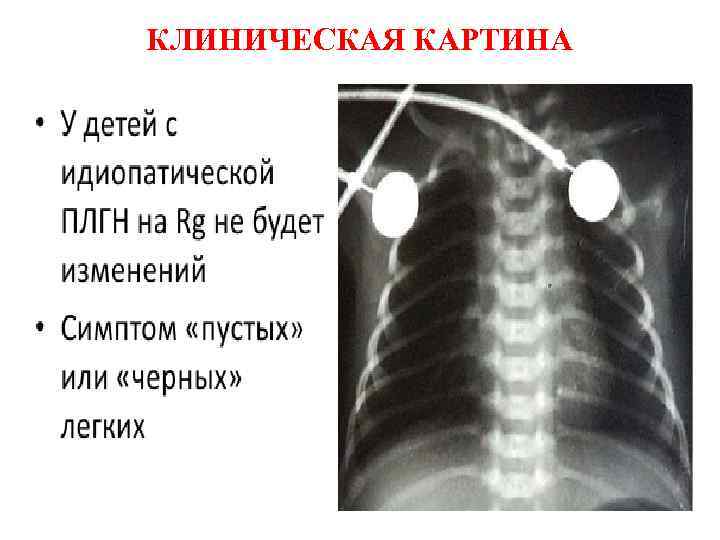 КЛИНИЧЕСКАЯ КАРТИНА 