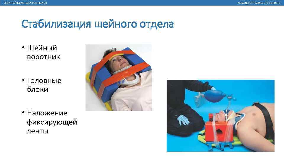 ВСЕУКРАЇНСЬКА РАДА РЕАНІМАЦІЇ Стабилизация шейного отдела • Шейный воротник • Головные блоки • Наложение