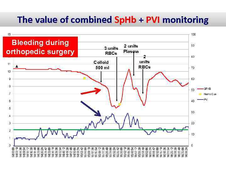 The value of combined Sp. Hb + PVI monitoring Bleeding during orthopedic surgery 3