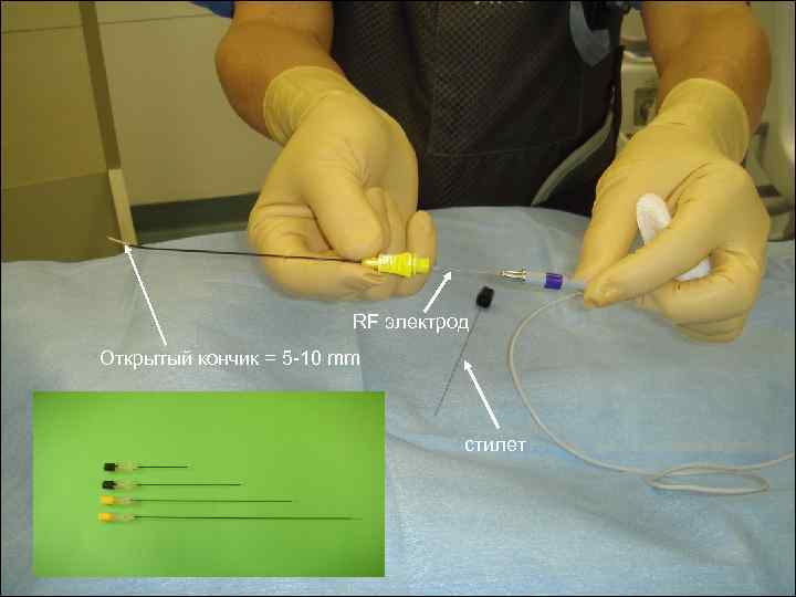 RF электрод Открытый кончик = 5 -10 mm стилет 