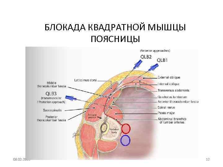 БЛОКАДА КВАДРАТНОЙ МЫШЦЫ ПОЯСНИЦЫ 08. 02. 2018 12 