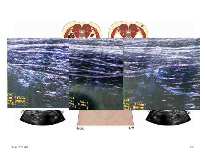 Ультразвуковая анатомия 08. 02. 2018 14 