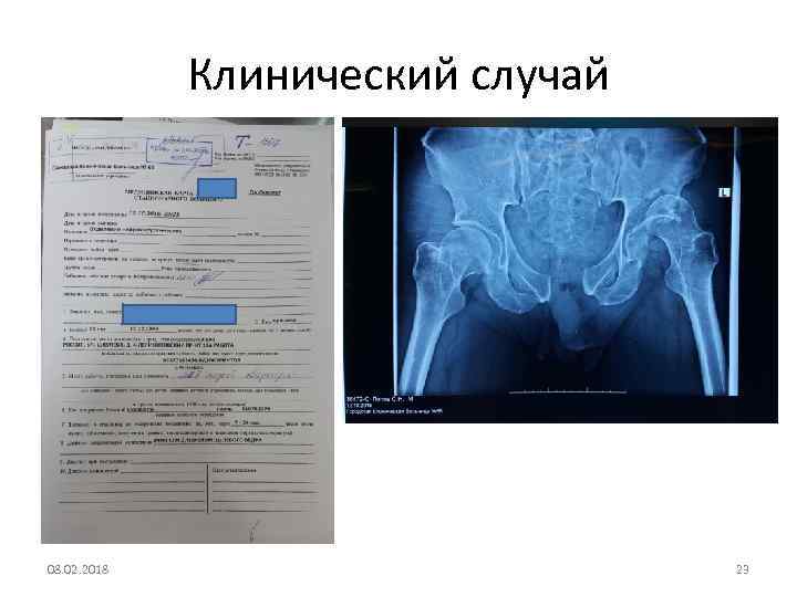 Клинический случай 08. 02. 2018 23 