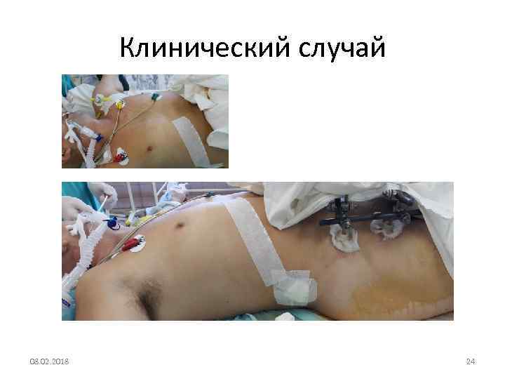 Клинический случай 08. 02. 2018 24 
