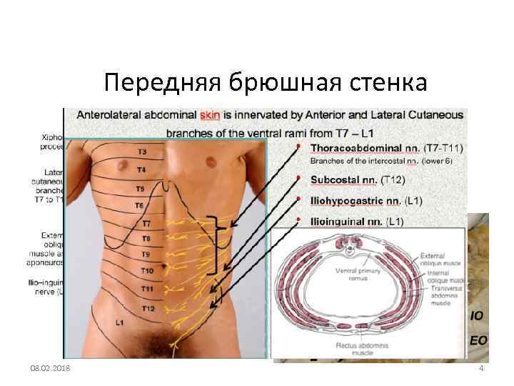 Границы переднебоковой стенки