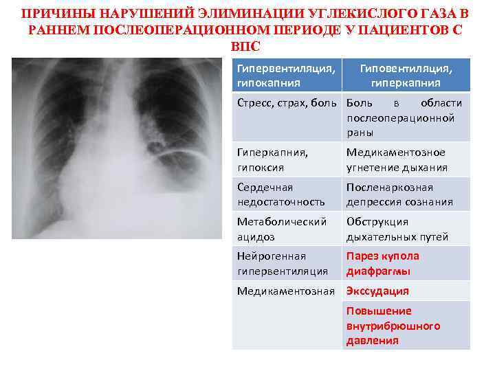 ПРИЧИНЫ НАРУШЕНИЙ ЭЛИМИНАЦИИ УГЛЕКИСЛОГО ГАЗА В РАННЕМ ПОСЛЕОПЕРАЦИОННОМ ПЕРИОДЕ У ПАЦИЕНТОВ С ВПС Гипервентиляция,