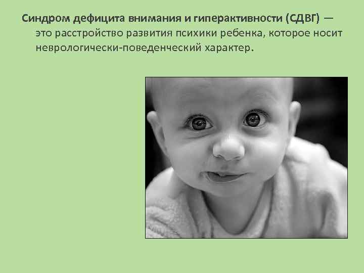Синдром дефицита внимания и гиперактивности (СДВГ) — это расстройство развития психики ребенка, которое носит