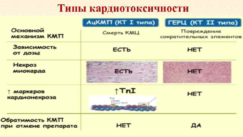 Типы кардиотоксичности 