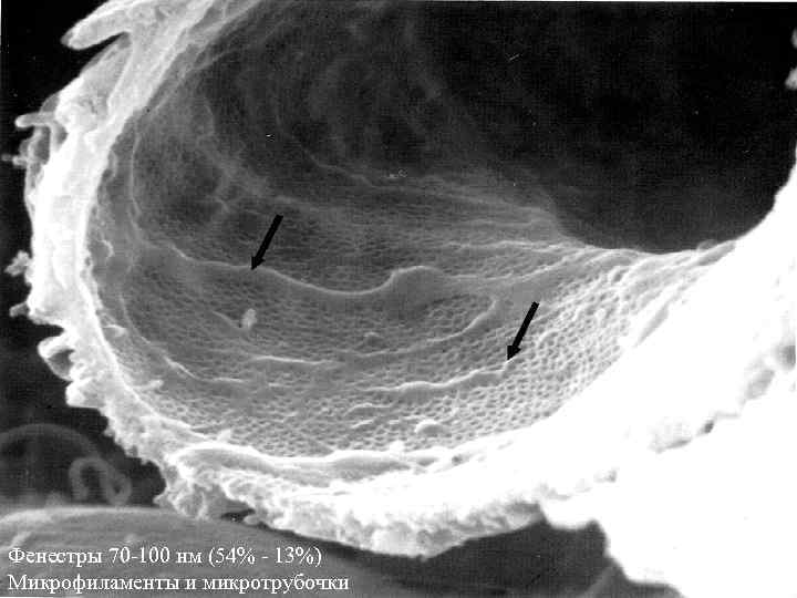 Фенестры 70 -100 нм (54% - 13%) Микрофиламенты и микротрубочки 28 