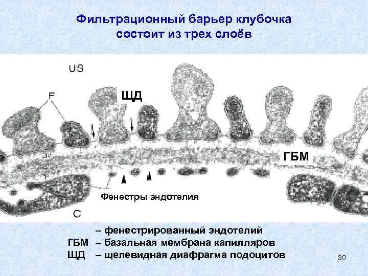 Фильтрационный барьер клубочка состоит из трех слоёв ЩД ГБМ Фенестры эндотелия фенестрированный эндотелий ГБМ