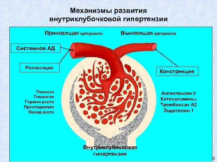 Механизмы развития внутриклубочковой гипертензии Приносящая артериола Выносящая артериола Системное АД Релаксация Констрикция Глюкоза Глюкагон