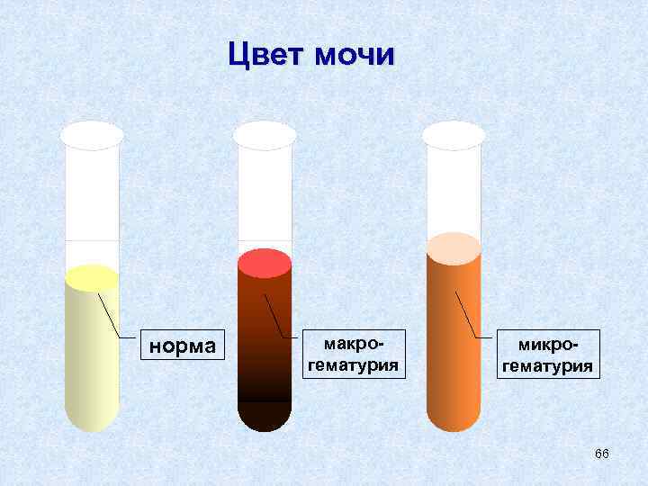 Цвет мочи норма макрогематурия микрогематурия 66 