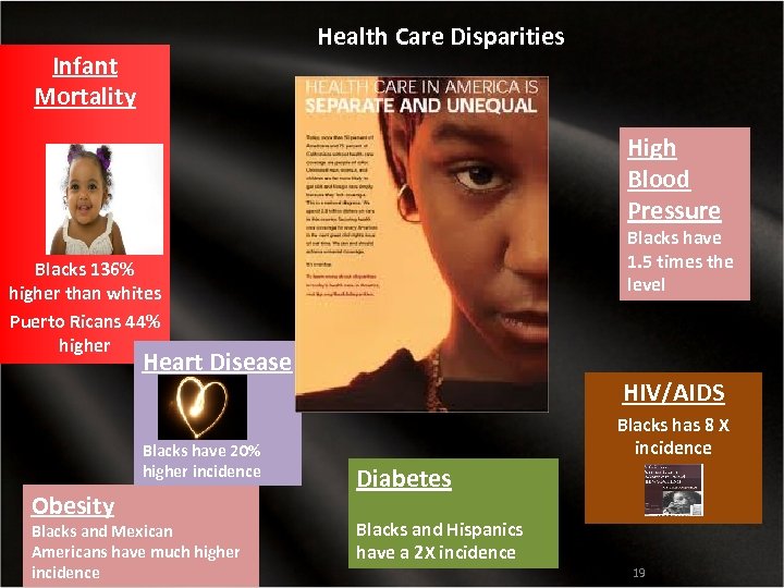 Health Care Disparities Infant Mortality High Blood Pressure Blacks have 1. 5 times the