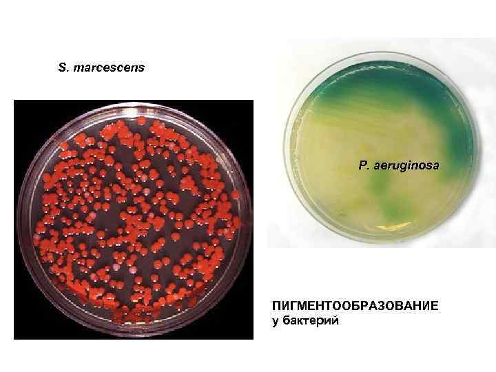 S. marcescens P. aeruginosa ПИГМЕНТООБРАЗОВАНИЕ у бактерий 