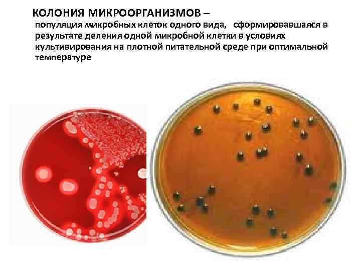  КОЛОНИЯ МИКРООРГАНИЗМОВ – популяция микробных клеток одного вида, сформировавшаяся в результате деления одной