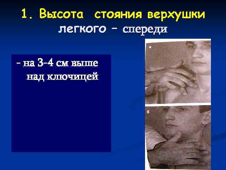 1. Высота стояния верхушки легкого – спереди - на 3 -4 см выше над