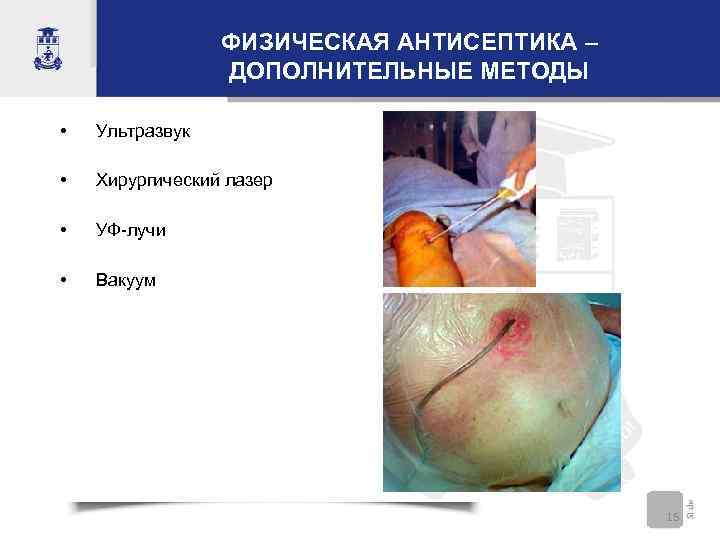 ФИЗИЧЕСКАЯ АНТИСЕПТИКА – ДОПОЛНИТЕЛЬНЫЕ МЕТОДЫ • Ультразвук • Хирургический лазер • УФ-лучи • Вакуум