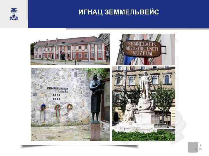ИГНАЦ ЗЕММЕЛЬВЕЙС 5 