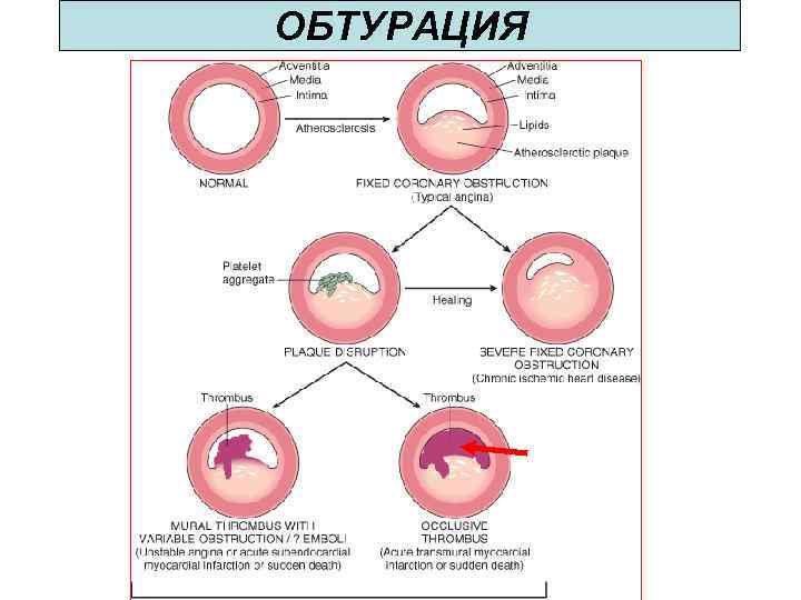 ОБТУРАЦИЯ 