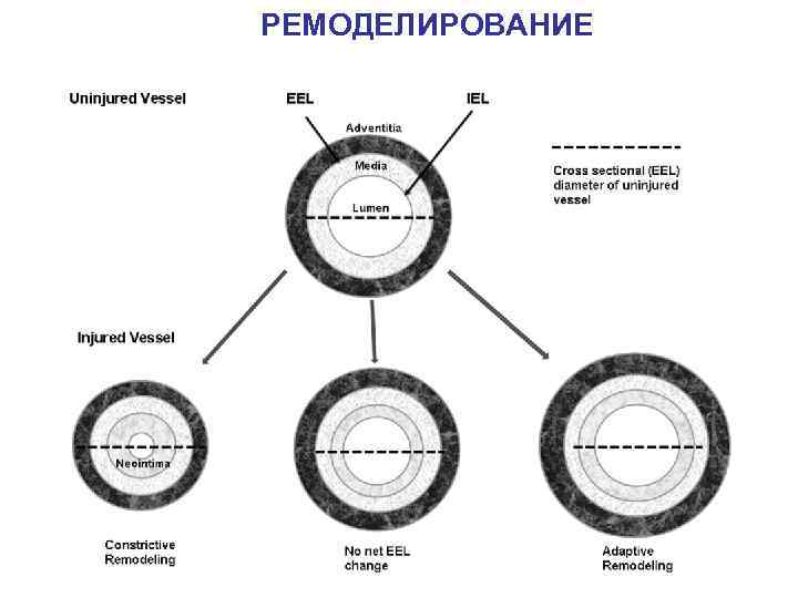 РЕМОДЕЛИРОВАНИЕ 