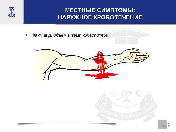 МЕСТНЫЕ СИМПТОМЫ: НАРУЖНОЕ КРОВОТЕЧЕНИЕ • Факт, вид, объем и темп кровопотери 26 