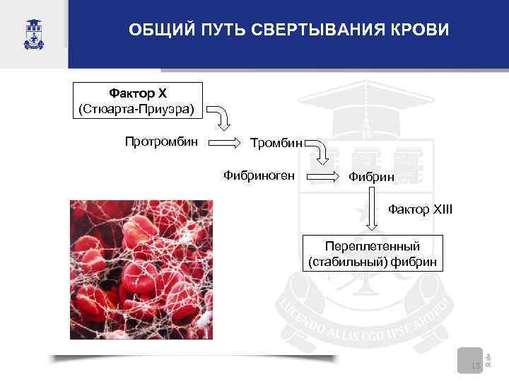 ОБЩИЙ ПУТЬ СВЕРТЫВАНИЯ КРОВИ Фактор X (Стюарта-Приуэра) Протромбин Тромбин Фибриноген Фибрин Фактор XIII Переплетенный