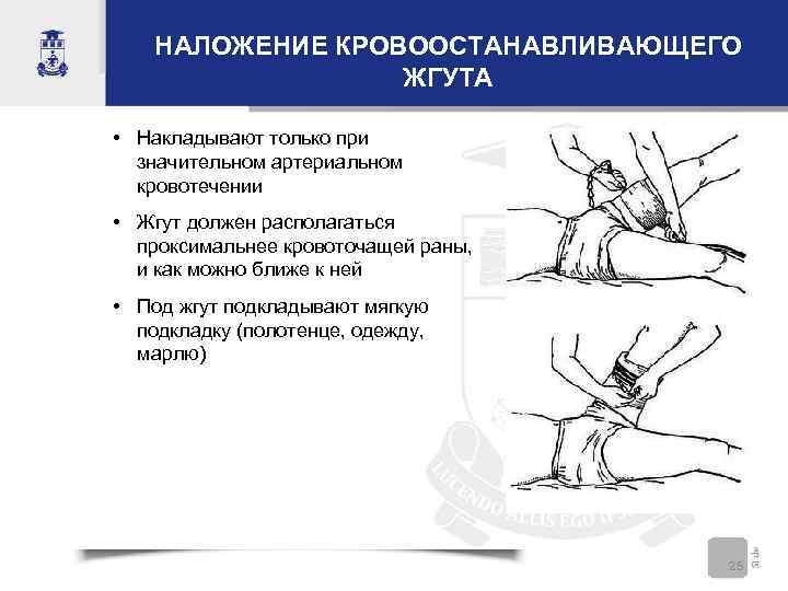 НАЛОЖЕНИЕ КРОВООСТАНАВЛИВАЮЩЕГО ЖГУТА • Накладывают только при значительном артериальном кровотечении • Жгут должен располагаться