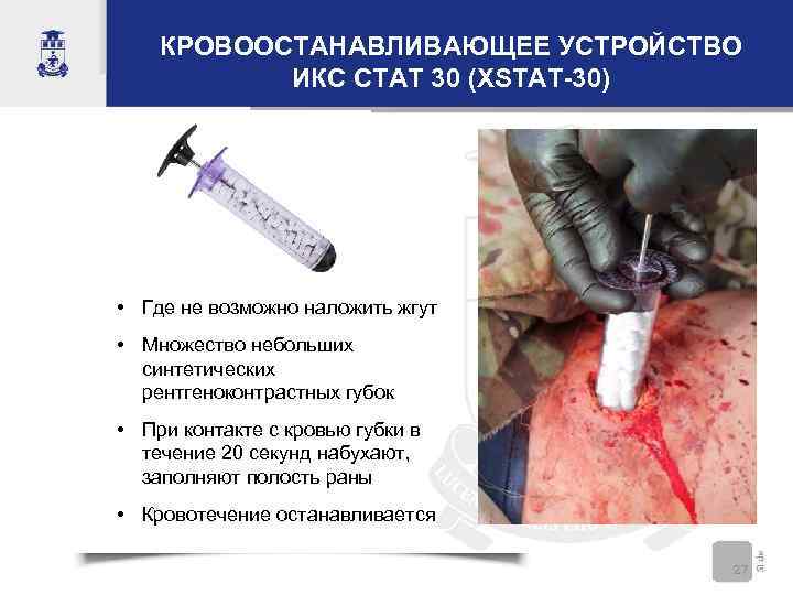 КРОВООСТАНАВЛИВАЮЩЕЕ УСТРОЙСТВО ИКС СТАТ 30 (XSTAT-30) • Где не возможно наложить жгут • Множество