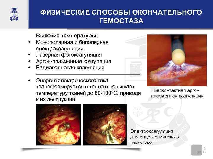 ФИЗИЧЕСКИЕ СПОСОБЫ ОКОНЧАТЕЛЬНОГО ГЕМОСТАЗА • • • Высокие температуры: Монополярная и биполярная электрокоагуляция Лазерная