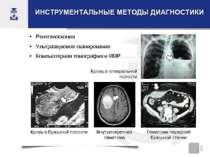 ИНСТРУМЕНТАЛЬНЫЕ МЕТОДЫ ДИАГНОСТИКИ • Рентгеноскопия • Ультразвуковое сканирование • Компьютерная томография и ЯМР Кровь