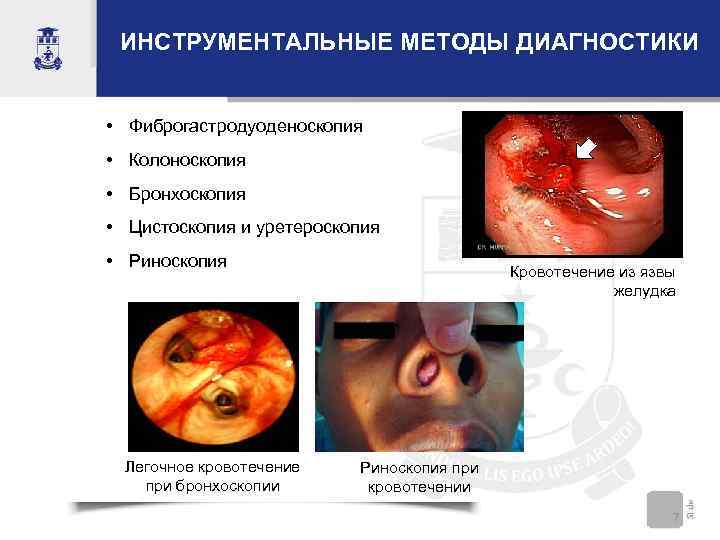 ИНСТРУМЕНТАЛЬНЫЕ МЕТОДЫ ДИАГНОСТИКИ • Фиброгастродуоденоскопия • Колоноскопия • Бронхоскопия • Цистоскопия и уретероскопия •