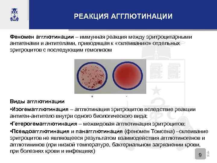 РЕАКЦИЯ АГГЛЮТИНАЦИИ Феномен агглютинации – иммунная реакция между эритроцитарными антигенами и антителами, приводящая к