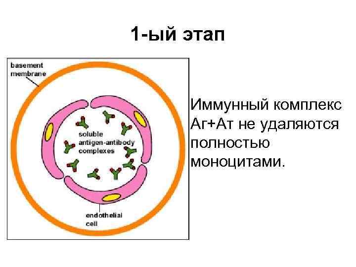 1 -ый этап Иммунный комплекс Аг+Ат не удаляются полностью моноцитами. 