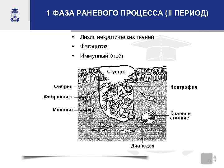 Раны и раневой процесс хирургия презентация