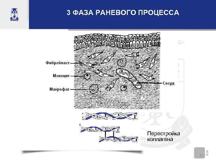 3 ФАЗА РАНЕВОГО ПРОЦЕССА Перестройка коллагена 21 