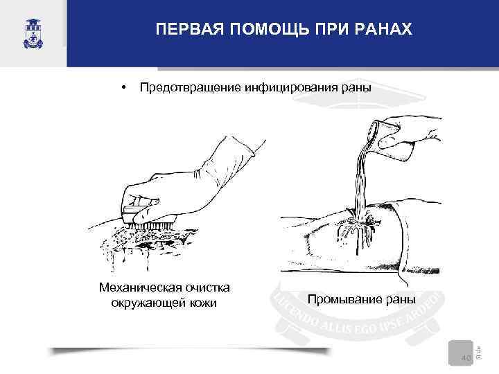 Картинки дренирование раны