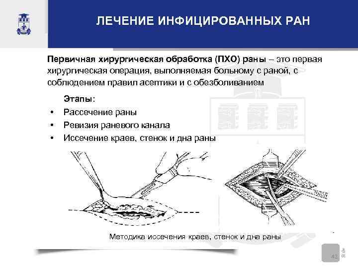 Первичная хирургическая обработка ран