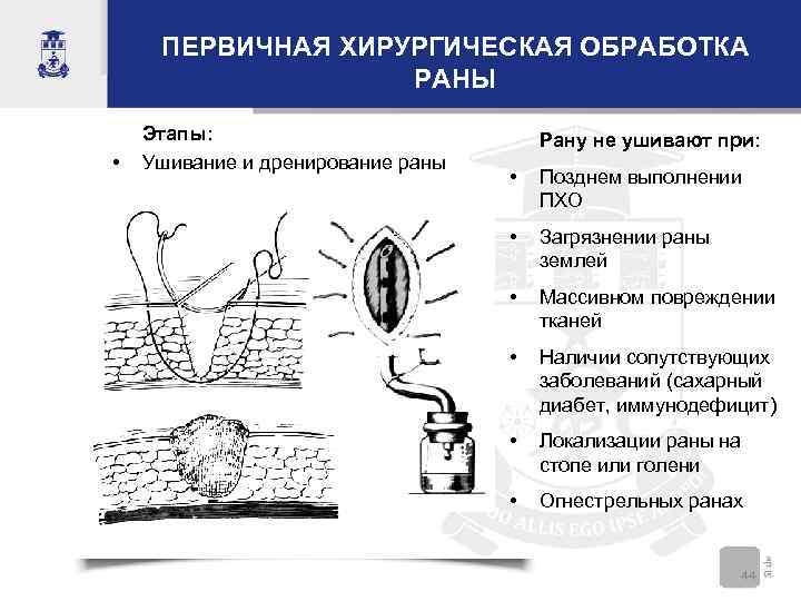 Пхо. Хирургическая обработка загрязненной раны. Дренирование операционной раны шов. Этапы Пхо дренирование раны..