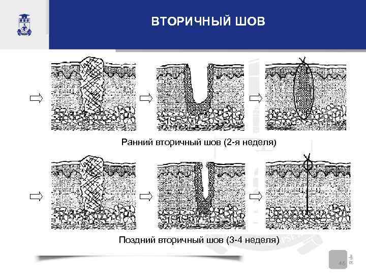 Хлопать преждевременно швы отстрочены подрезанные деревья