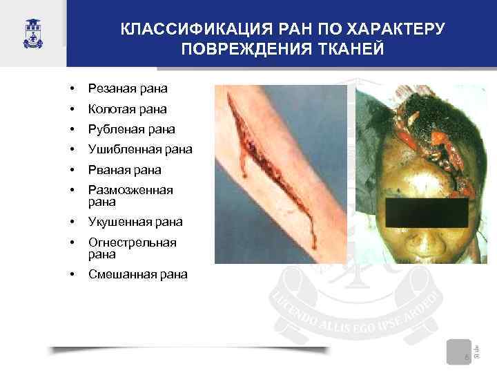 КЛАССИФИКАЦИЯ РАН ПО ХАРАКТЕРУ ПОВРЕЖДЕНИЯ ТКАНЕЙ • Резаная рана • Колотая рана • Рубленая